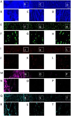 Confocal Microscopy-Based Estimation of Parameters for Computational Modeling of Electrical Conduction in the Normal and Infarcted Heart